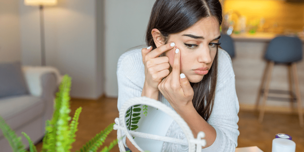 Acne Scars: What’s the Best Treatment Acne scars